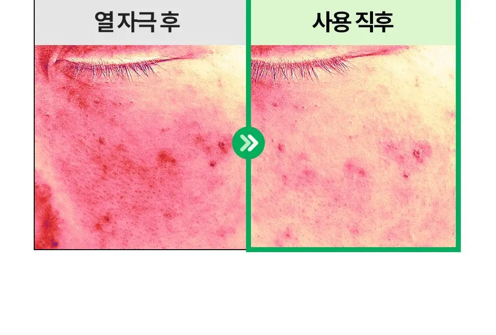 [밀착진정] 듀이트리 AC 딥 진정 마스크 1매 (열감/흔적) 상세페이지 27